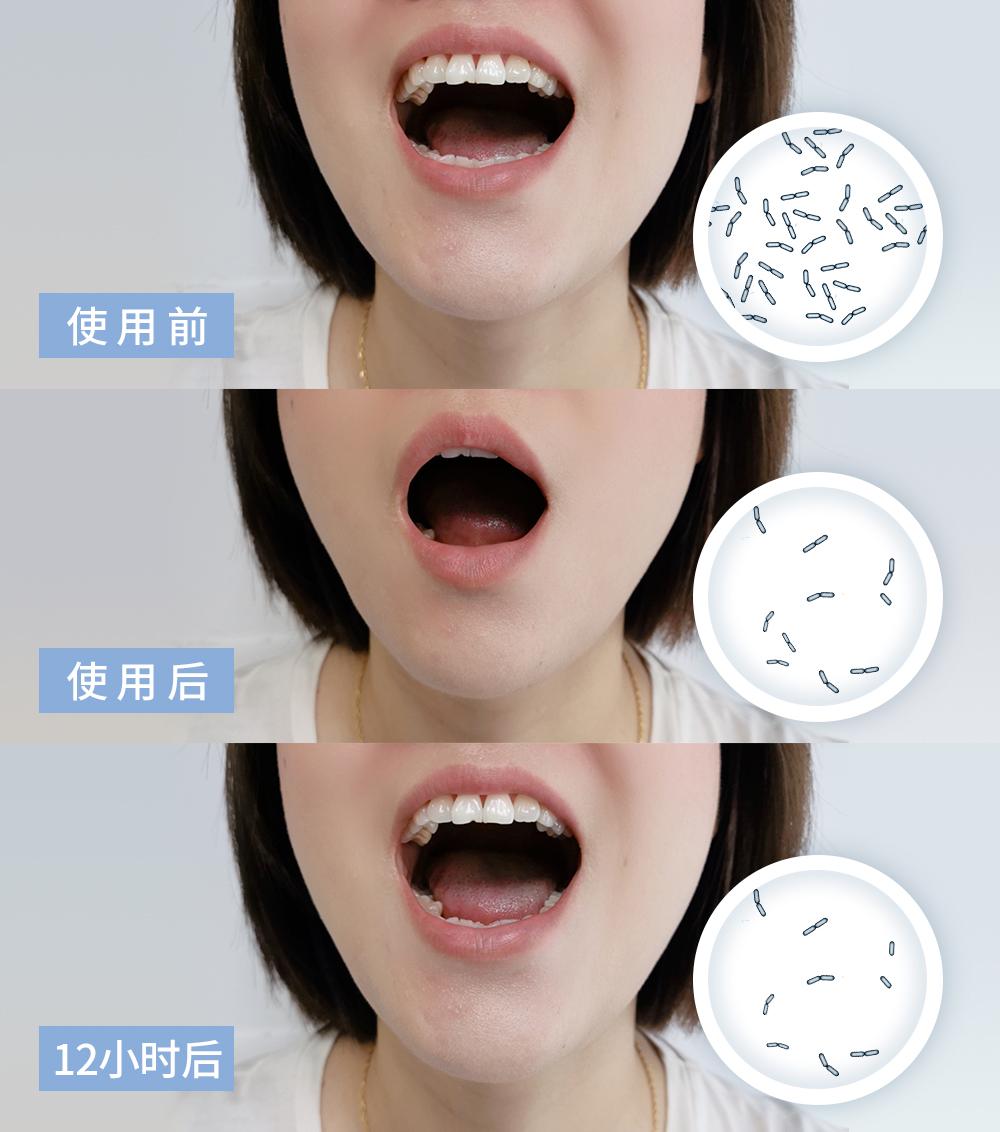 口臭的解决方法胃不好,口臭可能是你的胃出了问题