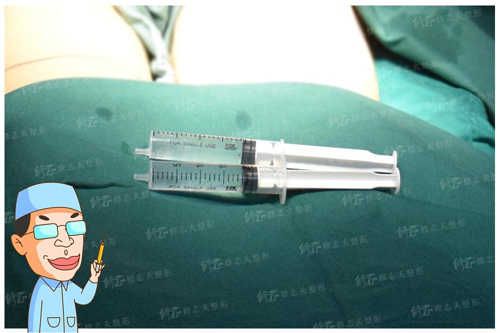 抽出来的脂肪为什么是液体,抽出来的脂肪去哪里了