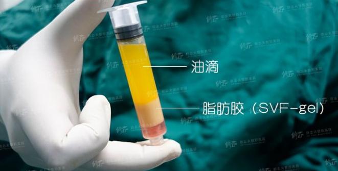 抽出来的脂肪为什么是液体,抽出来的脂肪去哪里了