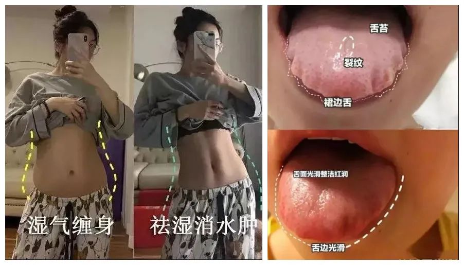 经常半夜醒来睡不着是这三处堵了,总是半夜一点多醒是啥病