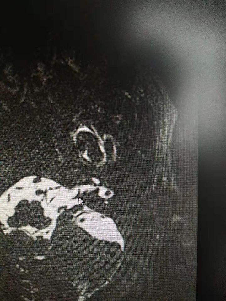 搬家后站立都成了奢望，59岁阿姨：一天头晕几十回，真是因为风水不好吗？