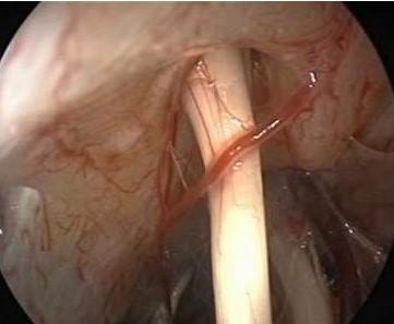 搬家后站立都成了奢望，59岁阿姨：一天头晕几十回，真是因为风水不好吗？