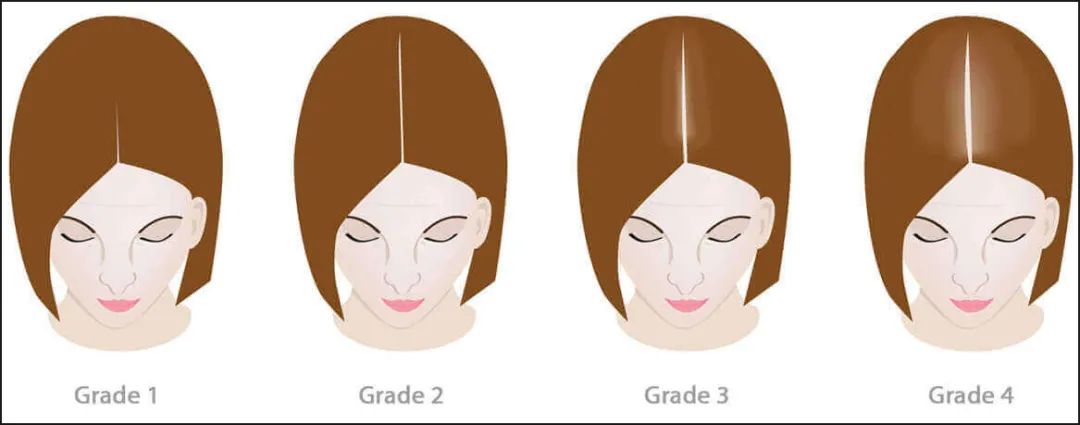 来给大家分享几款秋冬实用发型,秋冬必备发型教程