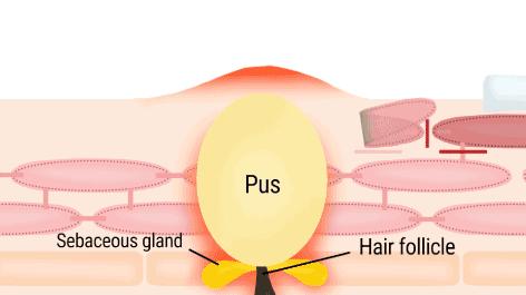 还在用洗面奶、磨砂膏？这款肌肤吸尘器，天然去角质，深度清洁毛孔，用完后整张脸都透气了