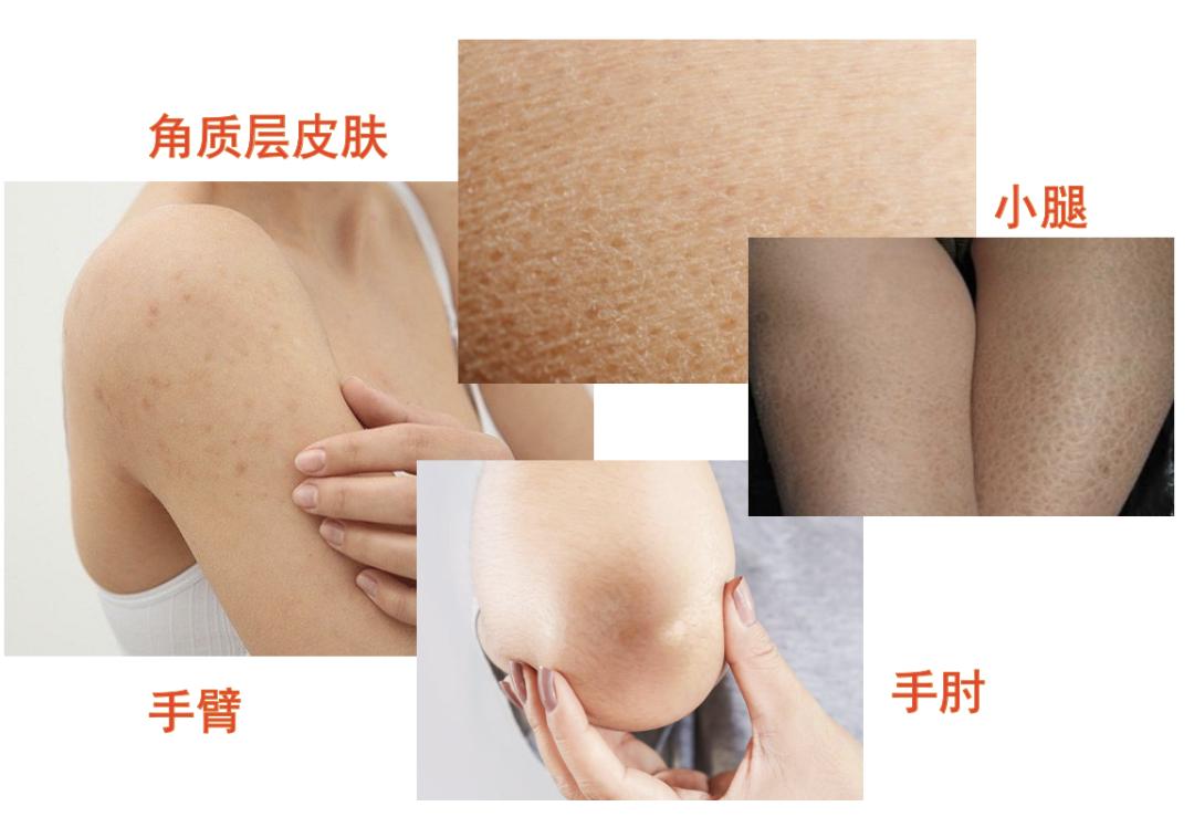 还在用洗面奶、磨砂膏？这款肌肤吸尘器，天然去角质，深度清洁毛孔，用完后整张脸都透气了