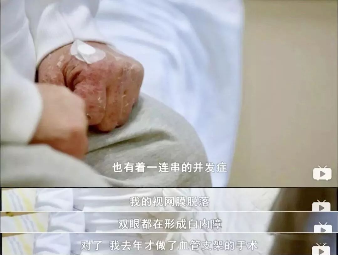 皮肤干的女生用的网红面膜,冬天女生脸部干燥用什么护肤品