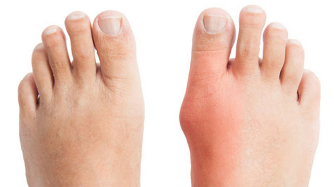 小小Jio趾在跑步中扮演了多重要的Jio色？