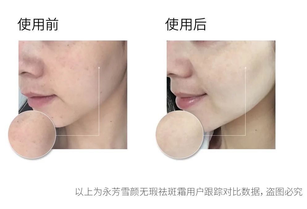 亲自用过有效的美白产品,自己用过的护肤品推荐