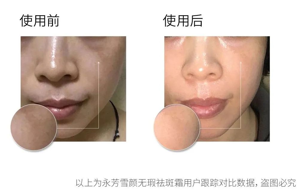 亲自用过有效的美白产品,自己用过的护肤品推荐