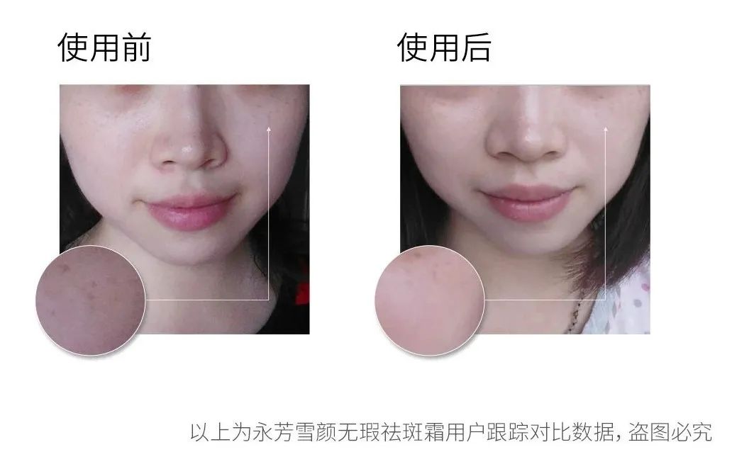 亲自用过有效的美白产品,自己用过的护肤品推荐