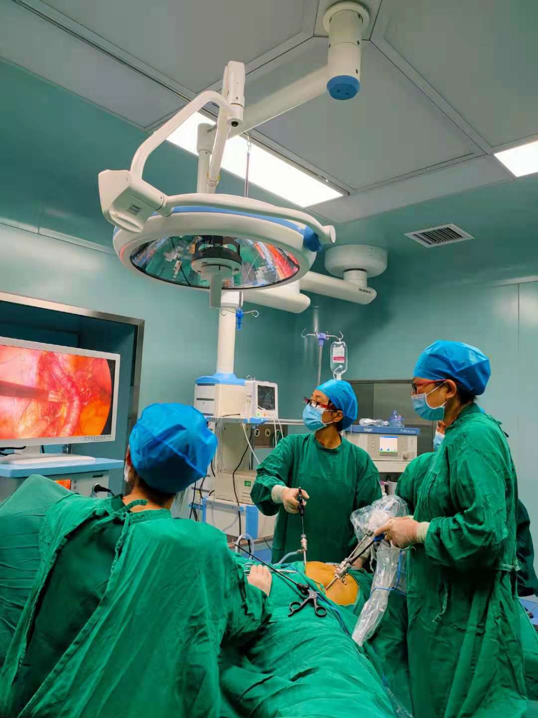 宫颈癌早期做了腹腔镜下根治手术,富源人民医院微创科