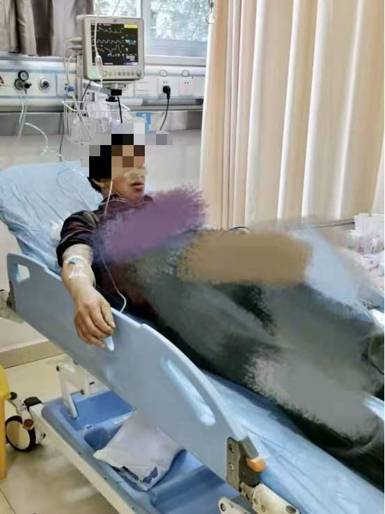 台州男子吃了两口生的“野芋头”，嘴肿成香肠！医生：那是滴水观音啊