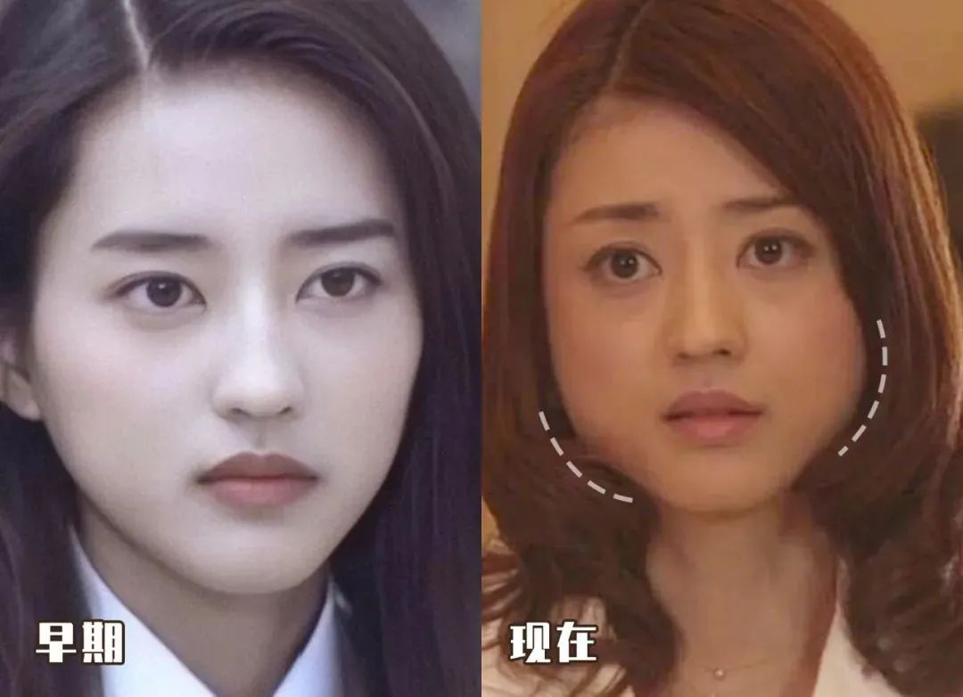 脸越来越圆胖是怎么回事,为什么腮和脸突然胖了好多