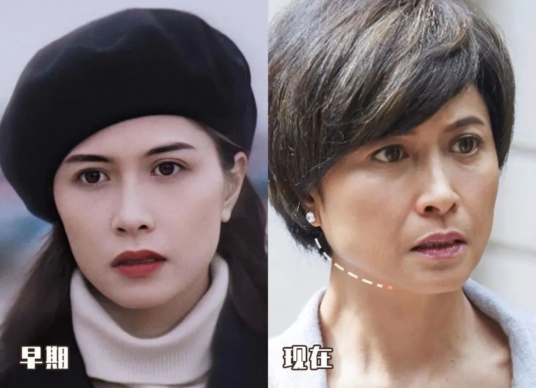 脸越来越圆胖是怎么回事,为什么腮和脸突然胖了好多