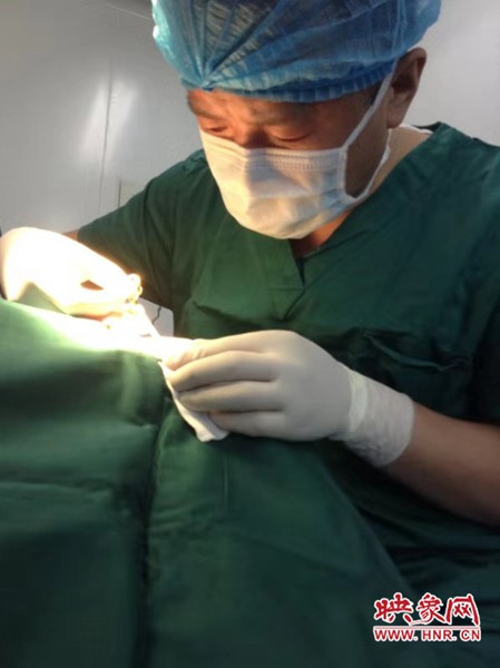 许昌博爱医院张保军双眼皮,许昌博爱医院张保军做鼻子