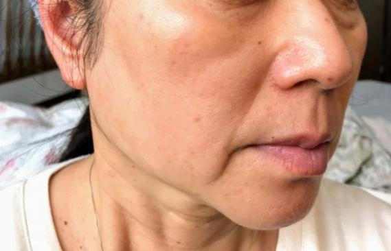 日本美容师法令纹按摩手法教程,精华按摩淡化法令纹手法