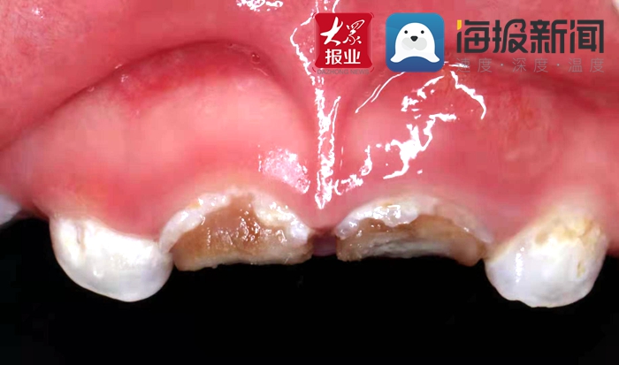 菏泽市立医院口腔科补牙多少钱,菏泽市立医院口腔科专业