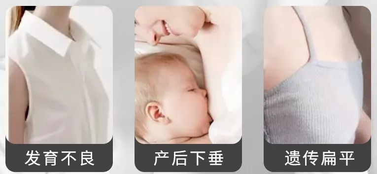 怎么丰胸安全又见效快不用吃药,丰胸除了按摩有什么方法