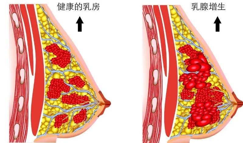 怎么丰胸安全又见效快不用吃药,丰胸除了按摩有什么方法