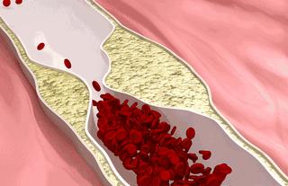 怎么丰胸安全又见效快不用吃药,丰胸除了按摩有什么方法