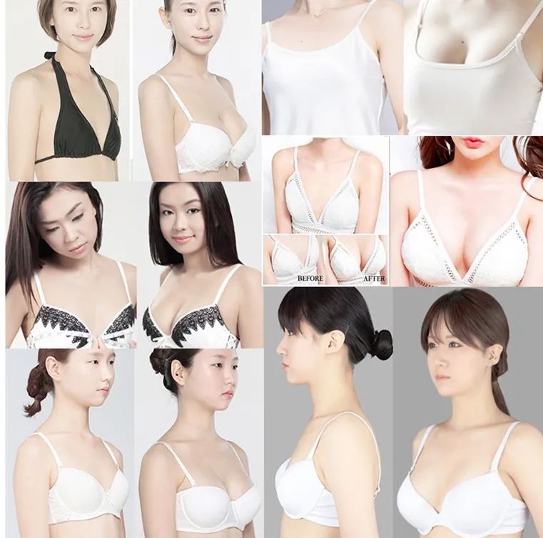 怎么丰胸安全又见效快不用吃药,丰胸除了按摩有什么方法