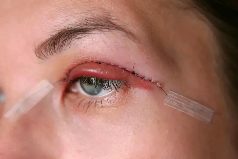 淡化疤痕原来淡疤可以这样做,每天用它擦一擦轻轻松松去除疤痕