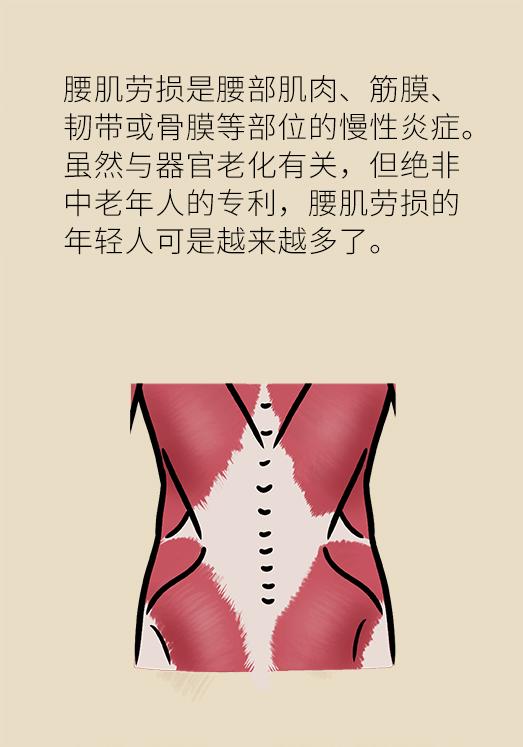 久坐腰肌劳损缓解腰痛的最佳方法,久坐导致的腰肌劳损治疗最佳方法