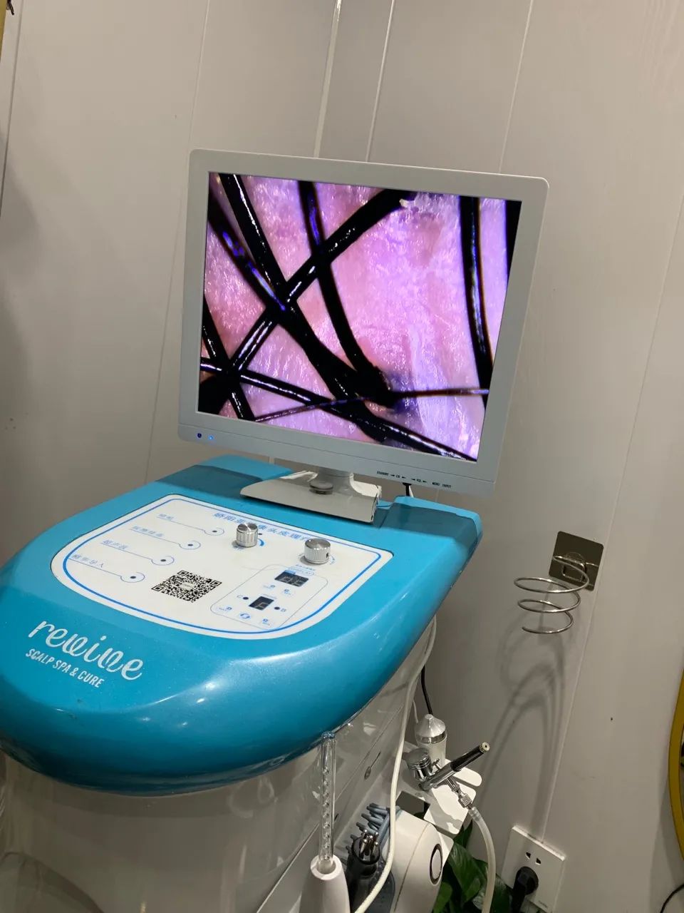 鏉窞濂崇敓鑴卞彂涓ラ噸,鏉窞24宀佸コ鑴卞彂涓ラ噸