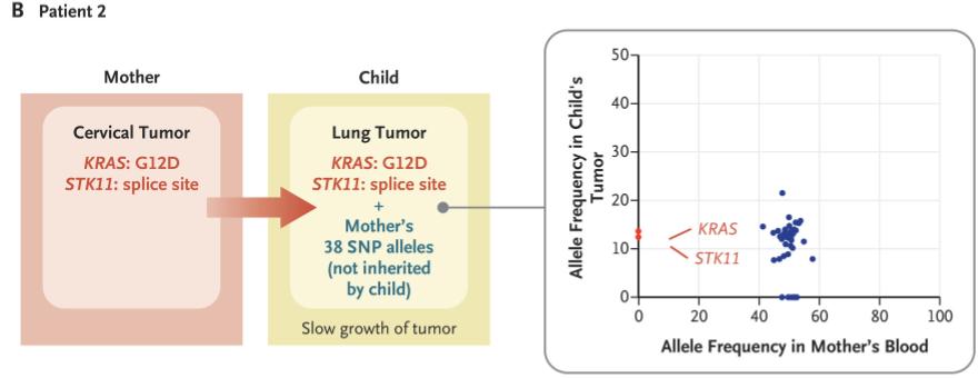NEJM：宫颈癌细胞竟能经产道进入婴儿的肺！科学家首次发现宫颈癌母亲顺产导致儿子患肺癌的案例，母子肿瘤基因谱高度吻合丨临床大发现