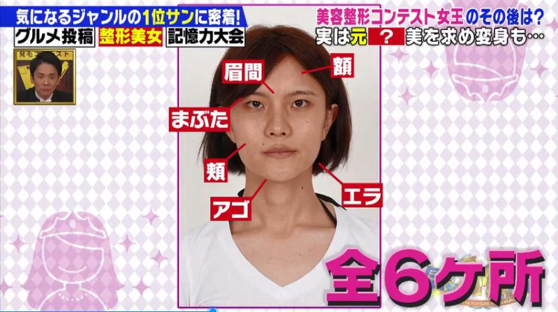 日本男子在泰国被逼做变性手术,日本男变女参加选美大赛