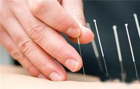 专病门诊有专家吗,江苏省人民医院面瘫专病门诊