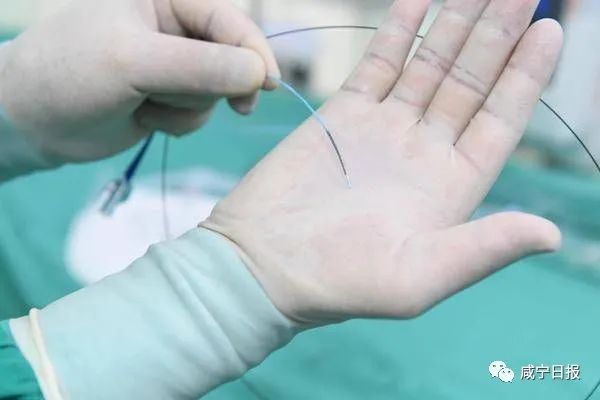 人均节省万余元!平价支架落地咸宁