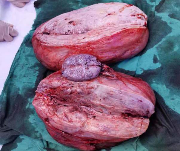 拆弹专家做手术,拆弹专家手术