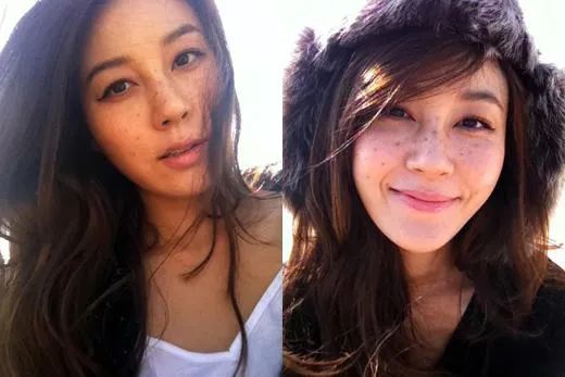 花了3万做激光,才彻底懂了:医生为什么劝你别去斑