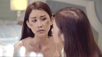 花了3万做激光,才彻底懂了:医生为什么劝你别去斑