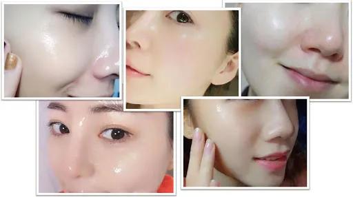 花了3万做激光,才彻底懂了:医生为什么劝你别去斑