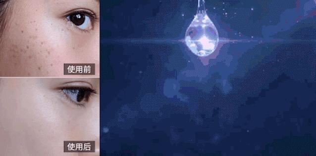 花了3万做激光,才彻底懂了:医生为什么劝你别去斑