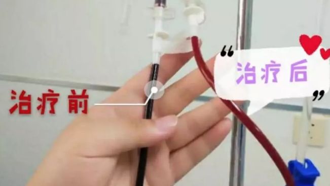 最近韩国瘦脸针事件新闻,韩国瘦脸针有国家批文了吗