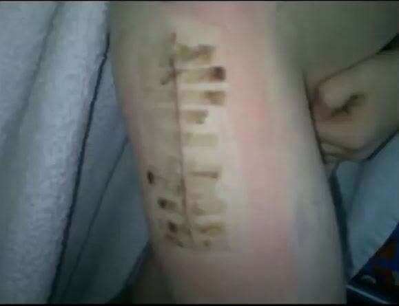 罹患重病也能成职业球员？足球这样给他第二次生命