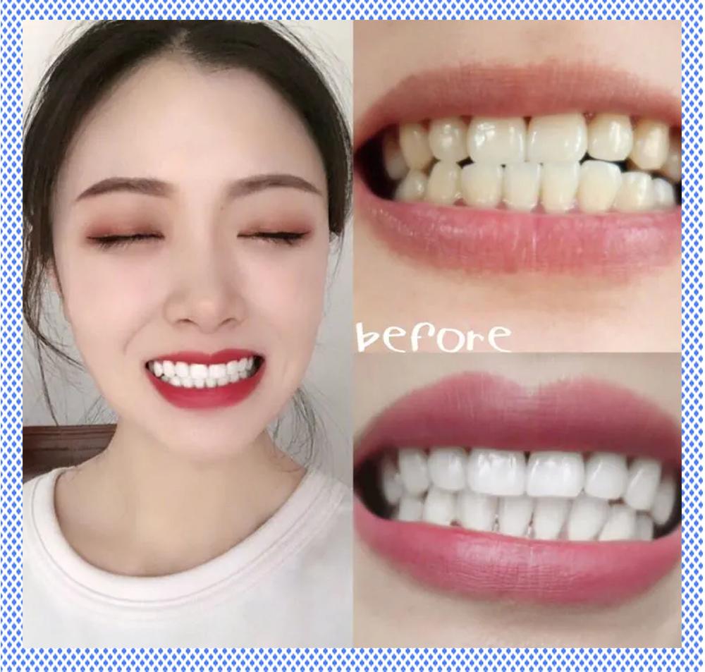 小红书电动牙刷,70元左右电动牙刷