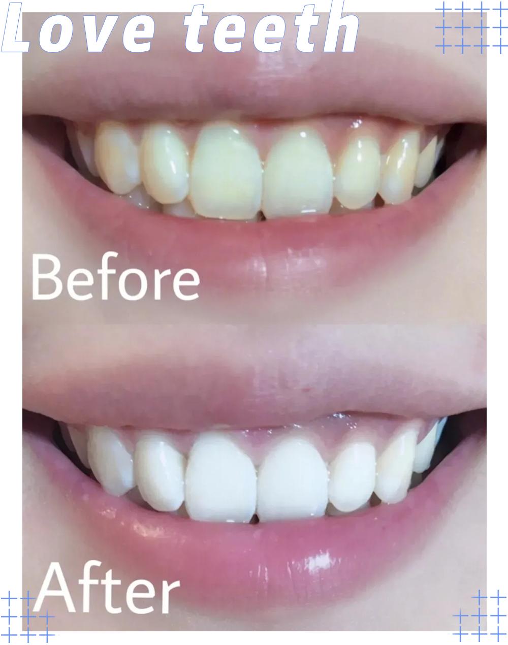 小红书电动牙刷,70元左右电动牙刷