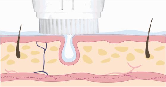 小红书电动牙刷,70元左右电动牙刷