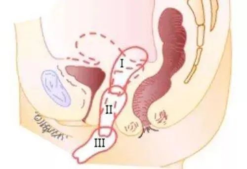 妇科专家在练的5招瑜伽，让你的轻中度子宫脱垂回位