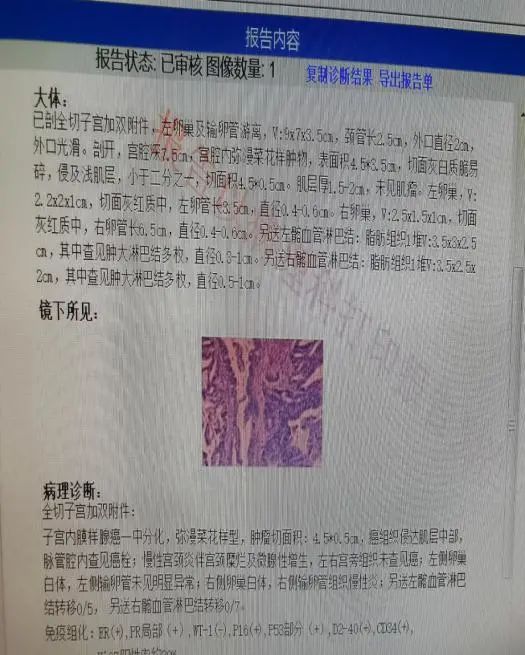 微创最新技术,微创再创新