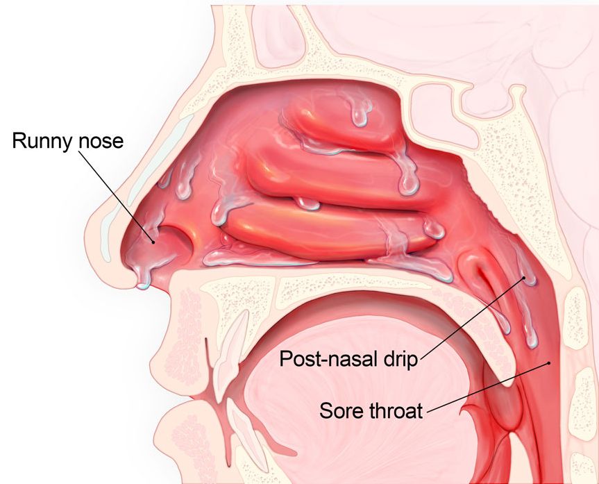 家长必须知道的十条规定,孩子流哪种鼻涕家长要注意