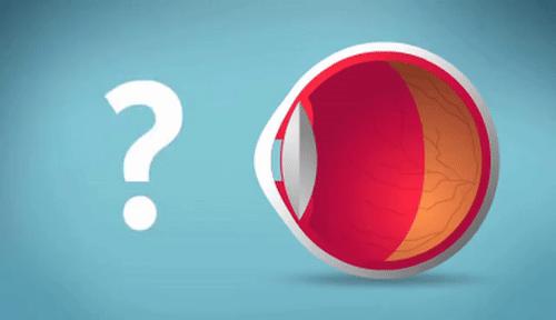 五岁半孩子眼睛散光需要干预吗,小孩眼睛散光跟家里灯光有关系吗