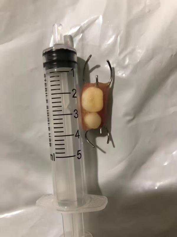假牙铁丝钩不小心吞下怎么办,不小心把假牙戴钩子吞了怎么办