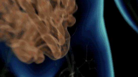 日本身体刮油神器推荐,日本超级好用的利器