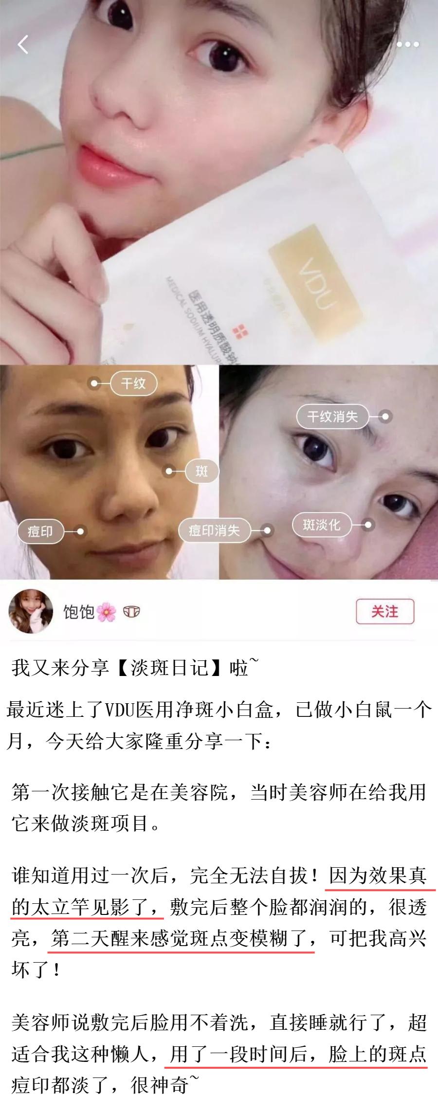 花了3万做激光，才彻底懂了：医生为什么劝你别去斑