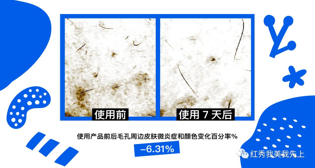 靠精华可以提升紧致吗,精华水可以收缩毛孔吗